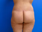 RGV Cosmetic Surgery Vein Care 