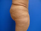 RGV Cosmetic Surgery Vein Care 