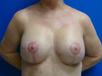 RGV Cosmetic Surgery Vein Care 