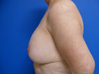 RGV Cosmetic Surgery Vein Care 