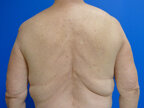 RGV Cosmetic Surgery Vein Care 