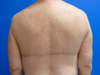 RGV Cosmetic Surgery Vein Care 