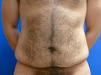 RGV Cosmetic Surgery Vein Care 