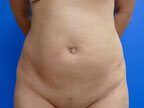 RGV Cosmetic Surgery Vein Care 
