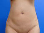 RGV Cosmetic Surgery Vein Care 