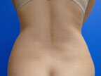 RGV Cosmetic Surgery Vein Care 