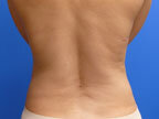 RGV Cosmetic Surgery Vein Care 