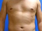 RGV Cosmetic Surgery Vein Care 