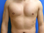 RGV Cosmetic Surgery Vein Care 