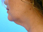 RGV Cosmetic Surgery Vein Care 