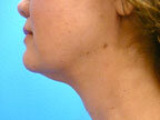 RGV Cosmetic Surgery Vein Care 