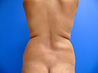 RGV Cosmetic Surgery Vein Care 