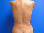 RGV Cosmetic Surgery Vein Care 