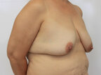 RGV Cosmetic Surgery Vein Care 