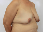 RGV Cosmetic Surgery Vein Care 