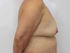RGV Cosmetic Surgery Vein Care 