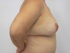 RGV Cosmetic Surgery Vein Care 
