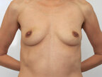 RGV Cosmetic Surgery Vein Care 