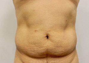 RGV Cosmetic Surgery Vein Care 