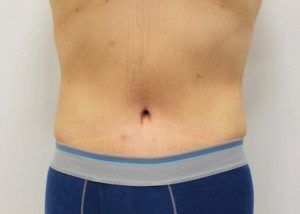 RGV Cosmetic Surgery Vein Care 