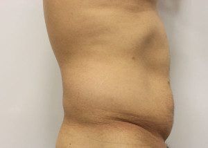RGV Cosmetic Surgery Vein Care 