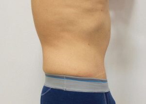RGV Cosmetic Surgery Vein Care 
