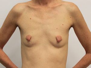 RGV Cosmetic Surgery Vein Care 