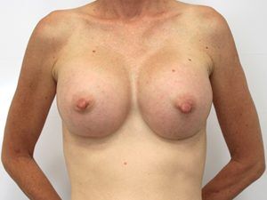 RGV Cosmetic Surgery Vein Care 