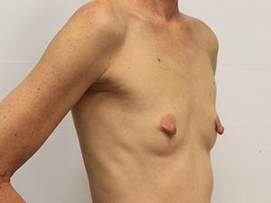 RGV Cosmetic Surgery Vein Care 