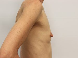 RGV Cosmetic Surgery Vein Care 
