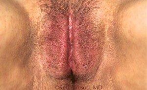 RGV Cosmetic Surgery Vein Care 