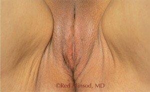 RGV Cosmetic Surgery Vein Care 