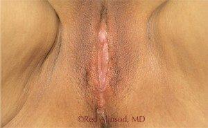 RGV Cosmetic Surgery Vein Care 