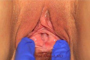 RGV Cosmetic Surgery Vein Care 