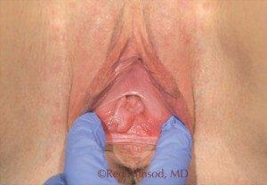 RGV Cosmetic Surgery Vein Care 