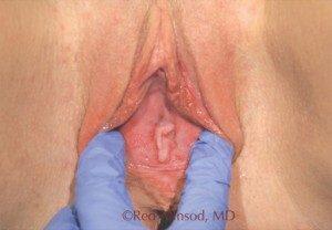 RGV Cosmetic Surgery Vein Care 