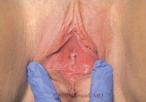RGV Cosmetic Surgery Vein Care 