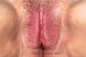 RGV Cosmetic Surgery Vein Care 
