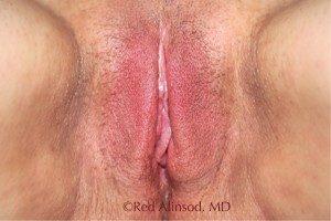 RGV Cosmetic Surgery Vein Care 