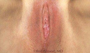RGV Cosmetic Surgery Vein Care 