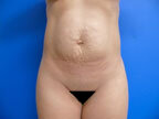 RGV Cosmetic Surgery Vein Care 