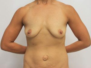 RGV Cosmetic Surgery Vein Care 