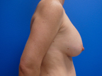 RGV Cosmetic Surgery Vein Care 