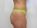 RGV Cosmetic Surgery Vein Care 