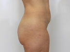 RGV Cosmetic Surgery Vein Care 