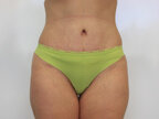 RGV Cosmetic Surgery Vein Care 