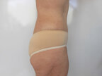 RGV Cosmetic Surgery Vein Care 