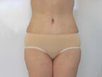 RGV Cosmetic Surgery Vein Care 