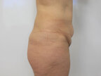 RGV Cosmetic Surgery Vein Care 