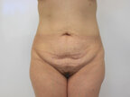 RGV Cosmetic Surgery Vein Care 